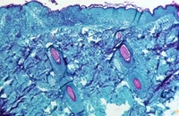 Một phần mô da được lấy từ vết thương trên da của một con khỉ bị nhiễm virus đậu mùa khỉ vào năm 1968.