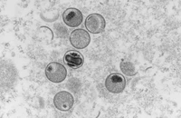 Ảnh chụp từ kính hiển vi điện tử cho thấy tiết diện siêu mỏng của virus đậu mùa khỉ.