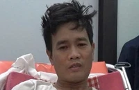 Chồng vừa sát hại vợ thì bị rắn độc cắn