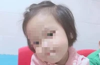 Bé 3 tuổi bị người tình của mẹ đóng đinh vào đầu đã tử vong