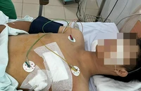 Cứu sống thiếu niên 16 tuổi bị đâm thủng tim, thủng phổi 