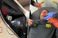 HLV Grosso của Lyon bị fan ném đá, máu đầm đìa