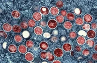 Hình ảnh hiển vi điện tử của virus “đậu mùa khỉ” hay “mpox”. Ảnh: AP