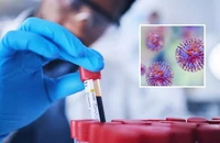 Hơn 300 mẫu virus nguy hiểm biến mất khỏi phòng thí nghiệm Úc