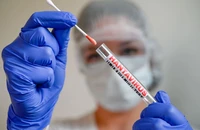 Tại sao dịch virus Hanta khác COVID-19?