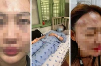 Cái kết khi tình cũ và tình cũ hơn của nam thanh niên gặp nhau