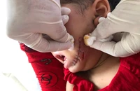 Cà Mau: Chó dại tấn công gây thương tích nặng cho bé 19 tháng tuổi