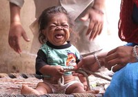 Kỳ lạ chàng thanh niên 23 tuổi trong hình hài em bé 1 tuổi