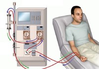 Bệnh nhân chạy thận nhân tạo dễ gặp những rủi ro nào?