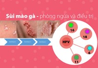 Từ vụ gần 80 trẻ mắc sùi mào gà: phòng ngừa và điều trị
