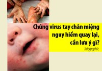 Chủng virus tay chân miệng nguy hiểm quay lại, cần lưu ý gì?