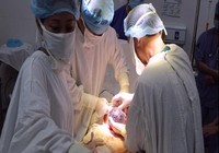 Sản phụ suy thận giai đoạn cuối vẫn sinh con khỏe mạnh
