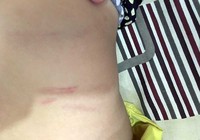 Con bị đánh, cha đề nghị trường bồi thường… 100 triệu đồng