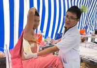 Chết vì... nuốt răng giả của mình