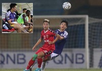 Thầy Park bị gãy hàng thủ