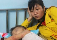 Bệnh tay-chân-miệng vào mùa
