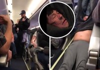 Toàn cảnh vụ bê bối United Airlines 'kéo lê hành khách'