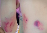 Công an vào cuộc vụ chánh văn phòng Huyện ủy đánh tài xế
