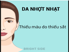 Dấu hiệu trên khuôn mặt cảnh báo sức khỏe có vấn đề