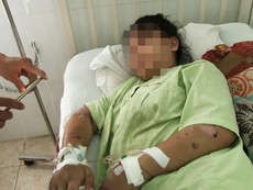 Cô gái kể về việc mình bị tra tấn dã man dẫn đến sẩy thai