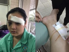 Người nhà cô bé 16 tuổi bị côn đồ cắt tai nói gì