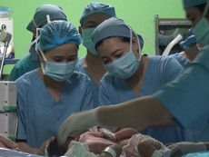 Tách thành công hai bé song sinh dính nhau phần gan