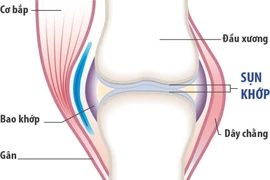 Thoái hóa khớp hay viêm khớp dạng thấp?