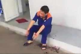 Công an điều tra vụ nhân viên cây xăng bị hành hung