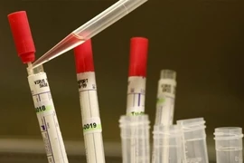 Cổ phiếu của các công ty sản xuất thuốc chữa Ebola tăng mạnh