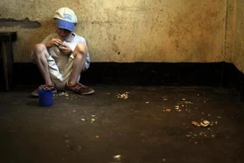Báo động hủ tục giết trẻ da đen bạch tạng lấy nội tạng hiến tế