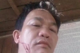 Chở gỗ lậu còn chửi bới rồi chém cán bộ kiểm lâm