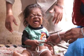 Kỳ lạ chàng thanh niên 23 tuổi trong hình hài em bé 1 tuổi
