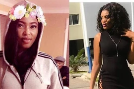 Nữ hoàng sắc đẹp Nigeria chết vì phẫu thuật mông