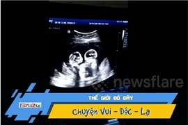 Buồn cười xem thai nhi song sinh “oánh nhau” trong bụng mẹ
