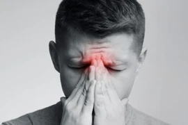 Đau đầu đột ngột: Cảnh báo căn bệnh nguy cơ tử vong nhanh chóng