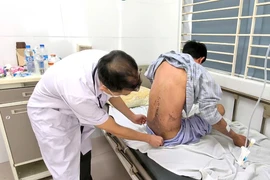 Bỏng toàn thân, mù tạm thời do tiếp xúc silicon chống dột