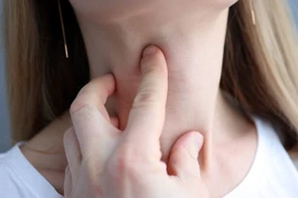Dấu hiệu nhận biết u tuyến giáp