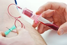 Xét nghiệm máu trong khám sức khỏe định kỳ: Cần lưu ý gì?