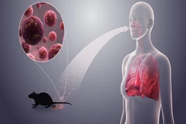 Bộ Y tế cảnh báo khẩn sau vụ 3 người tử vong do virus Hanta trên tàu du lịch