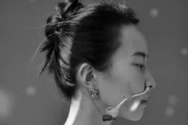 Lặng người với nghị lực phi thường của 'cô gái người máy' Trung Quốc 
