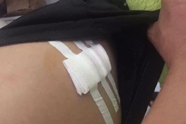 Người chở nạn nhân đi cấp cứu bị đâm trọng thương