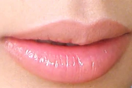 Đâm người ở cơ sở thẩm mỹ vì sửa môi không như ý