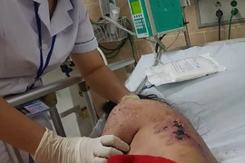 Không chịu kích dục chiều khách, cô gái trẻ bị tra tấn dã man 