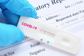 Đồng Nai không thu phí test nhanh COVID-19 của bệnh nhân, người chăm bệnh