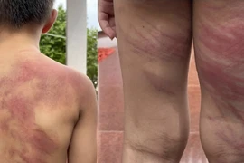 Khởi tố người cha hành hạ dã man con trai 5 tuổi ở Đồng Nai