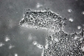 Phát hiện loại virus khiến con người bị ngớ ngẩn