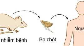 Triệu chứng bệnh dịch hạch và phòng ngừa