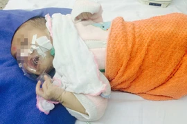 Bộ Y tế cảnh báo: Đang là thời 'cao điểm' của bệnh ho gà