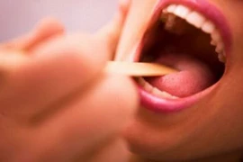 Khi nào nên cắt amidan?