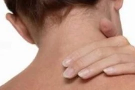 Cách khắc phục đau nhức sau khi ngủ dậy